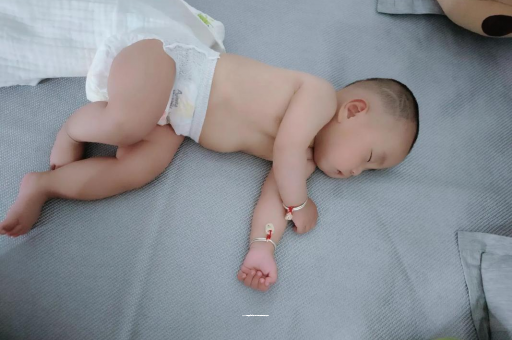 楚雄六个月宝宝眼睛散光